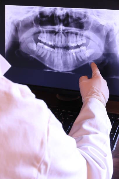 Best Emergency Dentist for Lost Fillings or Crowns in USA